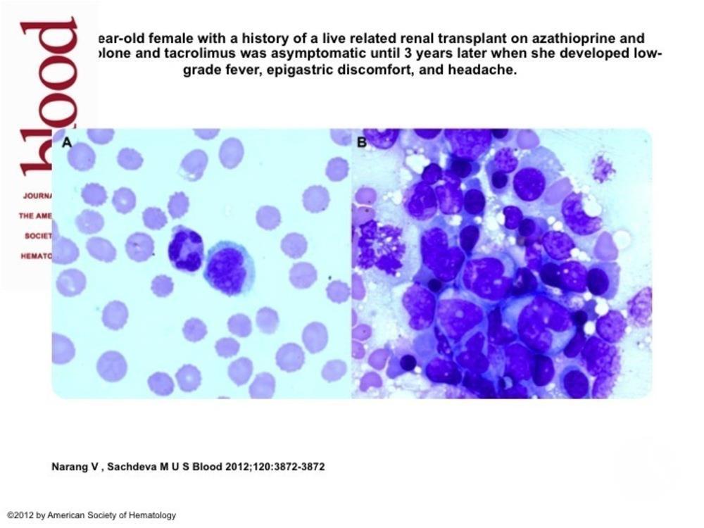 Posttransplantation and Pancytopenia