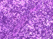 Normal Lymphoid Tissues: Part 3 - 5.