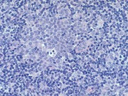 Normal Lymphoid Tissues: Part 3 - 7.