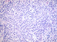 Normal Lymphoid Tissues: Part 3 - 8.