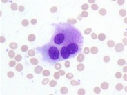 Bone Marrow Osteoclasts - 1.