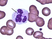 Neutrophil - Nuclear Appendages - 1.