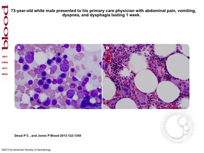 Pure white cell aplasia in a patient with thymic carcinoma