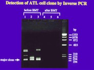 Adult T-cell Leukemia/Lymphoma - 5.