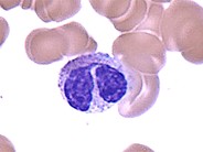 Pelger Huet Cell - 1.