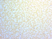 Leukocyte Alkaline Phosphatase Scoring - 1.