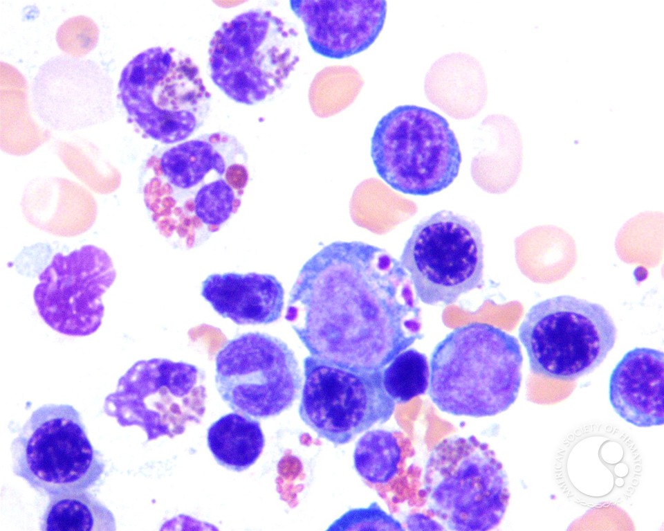 the superoxide forming nadph oxidase of phagocytes