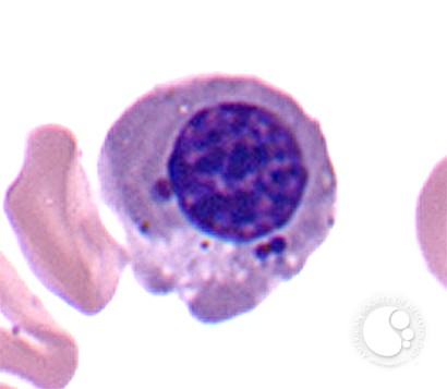 Howell-Jolly Bodies - 1.