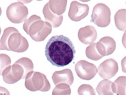 Plasmacytoid Lymphocyte 1.