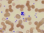 Neutrophil Apoptotis - 3.