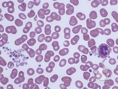 Leukocyte Phagocytosis of Platelets - 1.