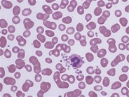 Leukocyte Phagocytosis of Platelets - 2.