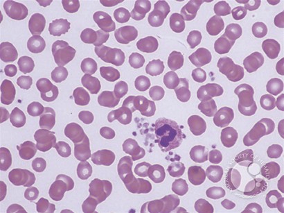 Leukocyte Phagocytosis of Platelets - 2.