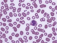 Leukocyte Phagocytosis of Platelets - 3.