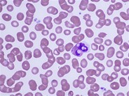 Leukocyte Phagocytosis of Platelets - 4.