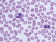 Leukocyte Phagocytosis of Platelets - 6.