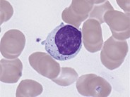 Large granular lymphocytes - 2.