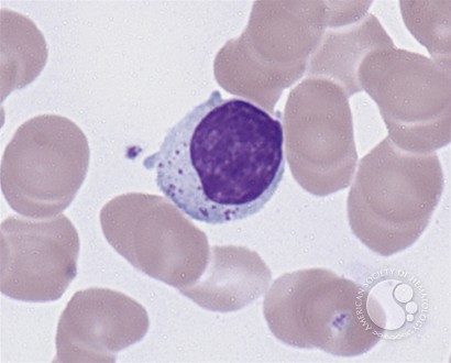 Large granular lymphocytes - 2.