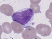 examples-of-the-different-lymphocytes-lymphocytes-classified-as-a