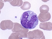 Monocytes - 3.