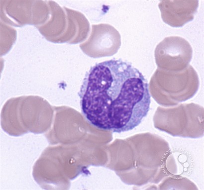 Monocytes - 3.