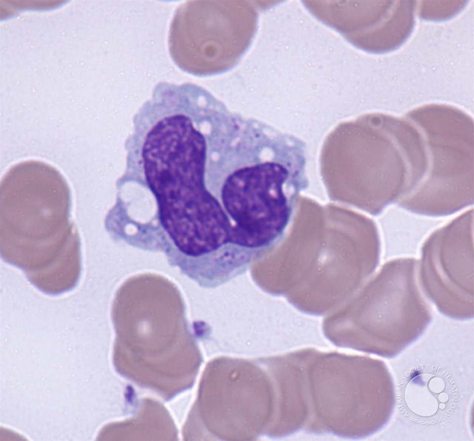 Monocytes - 5.