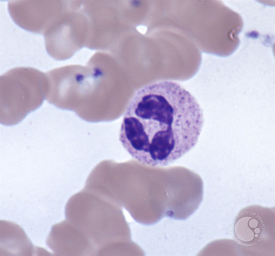 Neutrophils - 3.