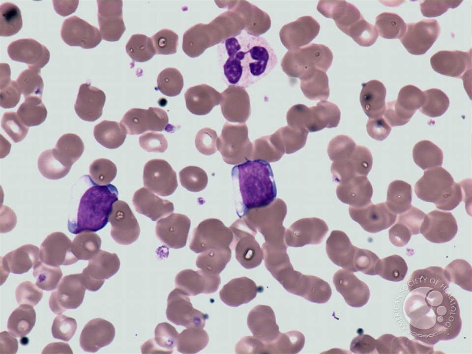 Cytogram - normal peripheral blood - 4.