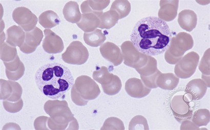 Cytogram - normal peripheral blood - 6.