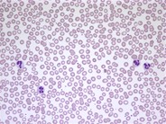 Normal peripheral blood smear - 1.