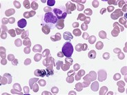 Hematogone - 1.
