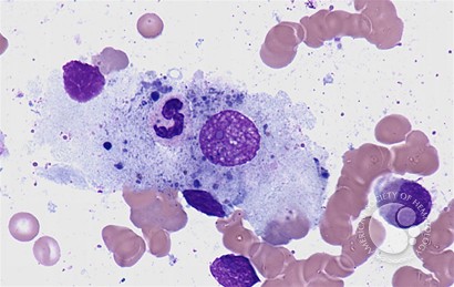Phagocytic macrophage - 1.