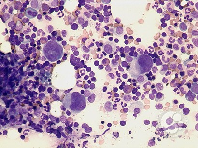 Early megakaryocytes - 1.