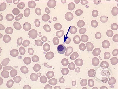 Nucleated red blood cell - 1.