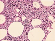 Normal adult bone marrow – trephine biopsy - 1.