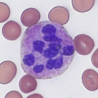 hypersegmented-neutrophil