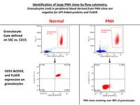 Aplastic Anemia and Paroxysmal Nocturnal Hemoglobinuria Flowcytometry