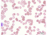 Stomatocytes