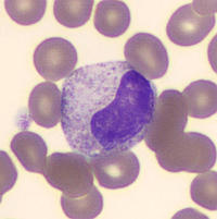 myeloblast vs promyelocyte