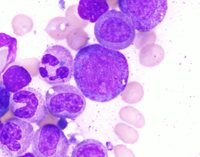 myelocyte and metamyelocyte