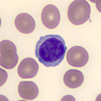 lymphocyte