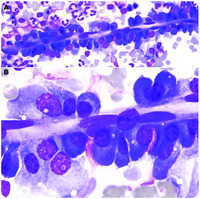 A plasma cell ribbon