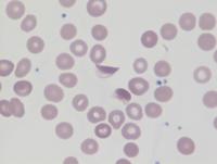Blister cells 2