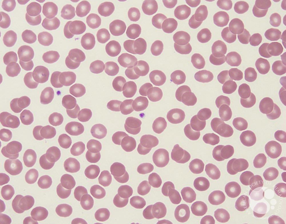 Normal platelet