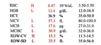 Microcytic RBCs with lymphocyte for comparison 2