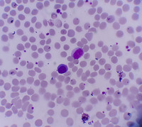 Lymphocyte morphology