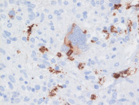 CD15 immunostain