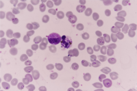 Plasmodium falciparum