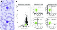 Morphology and flow cytometry of atypical basophils