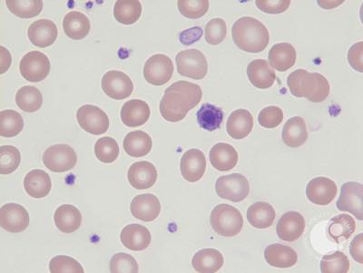 Blood-giant platelet